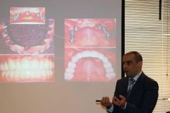 implant prosthetic therapy considerations_2