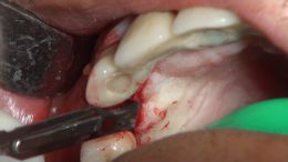 4-5-Mehr-98-Live-Surgery_1