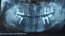 اصول مبانی GBR  - مدرس دکتر عمید