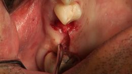 GBR - Course - 2019_5