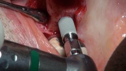 GBR - Course - 2019_7