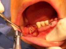 Third Osteology Symposium_14