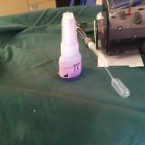 Immediate implementation and immediate loading_4