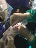 Two days Plastic surgery course with live surgery