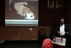 كارگاه معرفي مراحل جراحي و پروتز ايمپلنت SPI