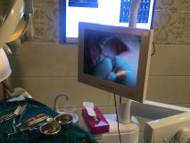 آموزش كاربردي چسب بافتي PeriAcryl كانادا همراه با جراحي زنده