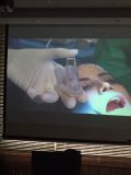 SPI system presentation with live surgery