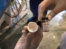 Fundamental of GBR with live surgery